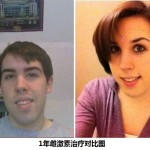 男子服用荷尔蒙变化过程记录图